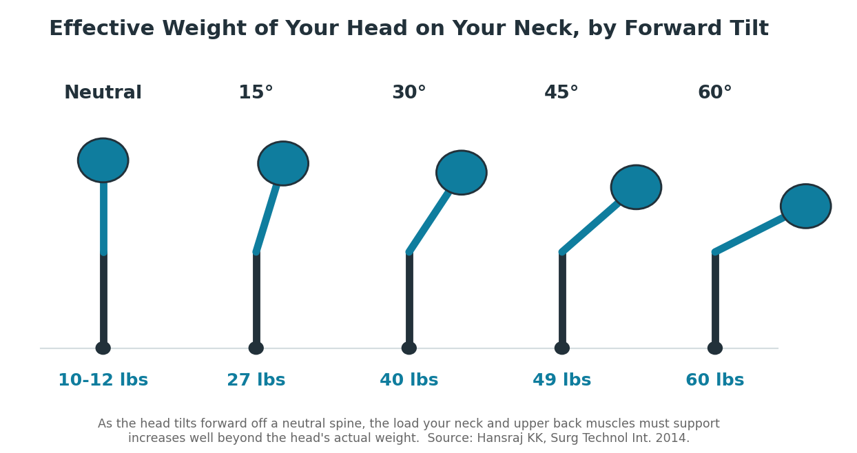 Diagram showing the effective weight of the head on the neck increasing from 10-12 pounds at neutral posture to 60 pounds at a 60-degree forward head tilt